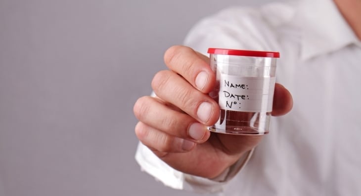 Man holding sperm donation pot